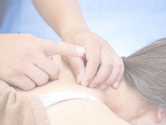 ＢＰ鍼灸整骨院の施術風景