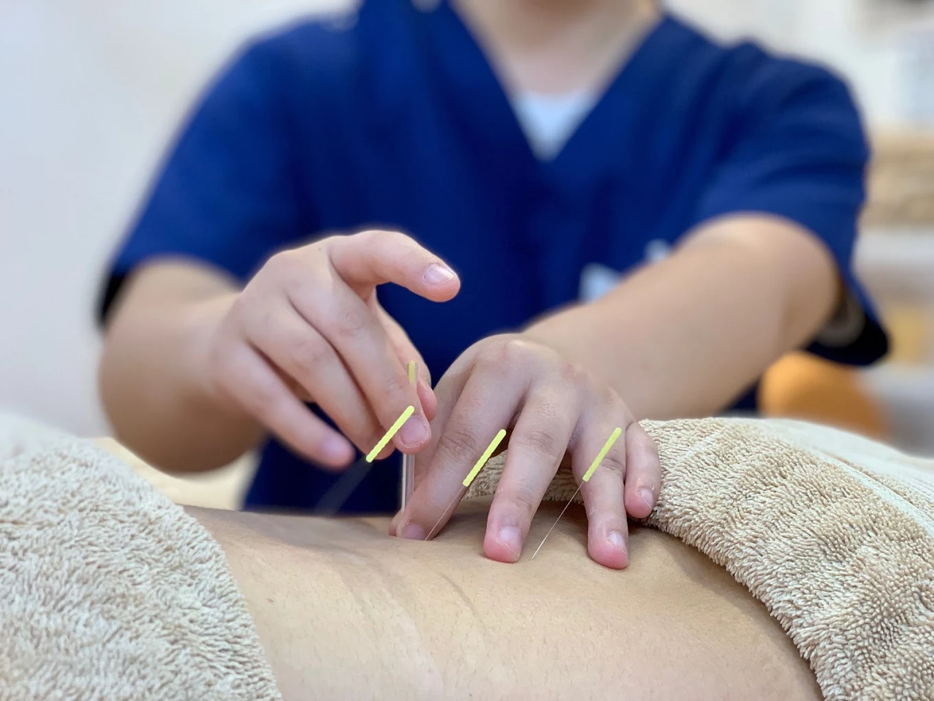 alt="さいたま市のはっとりはりきゅう接骨院西大宮院のムチウチ治療の様子"