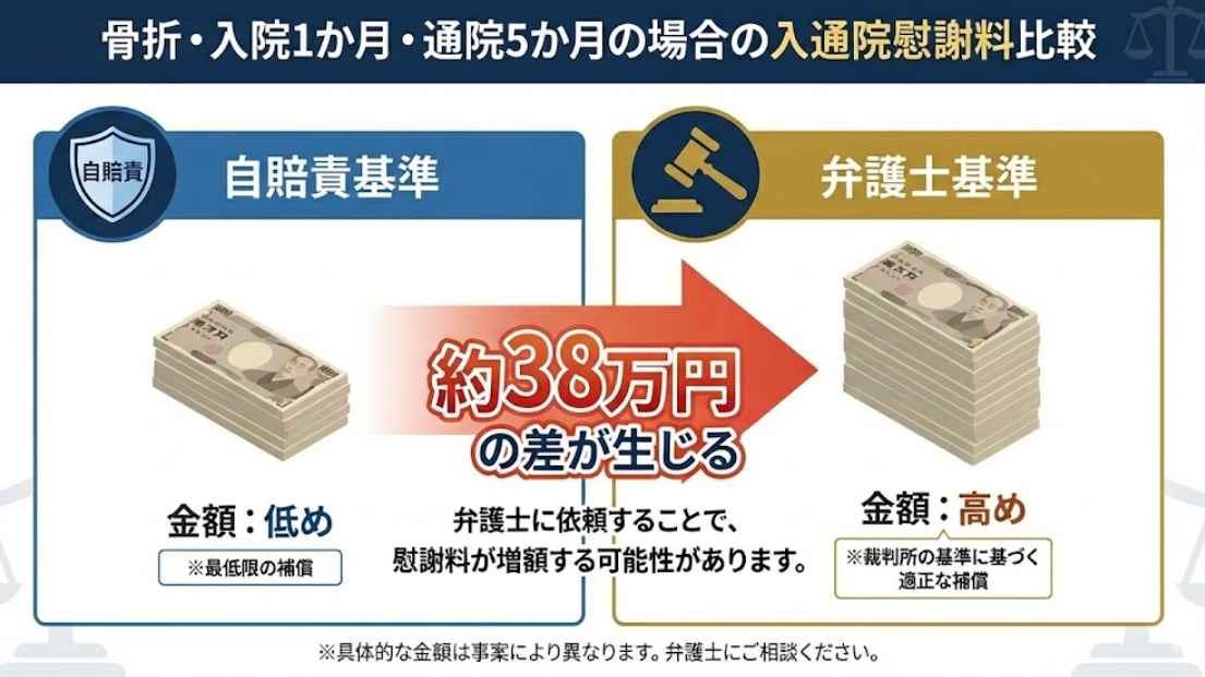 骨折・入院一ヶ月・通院5ヶ月の場合の乳通院慰謝料比較